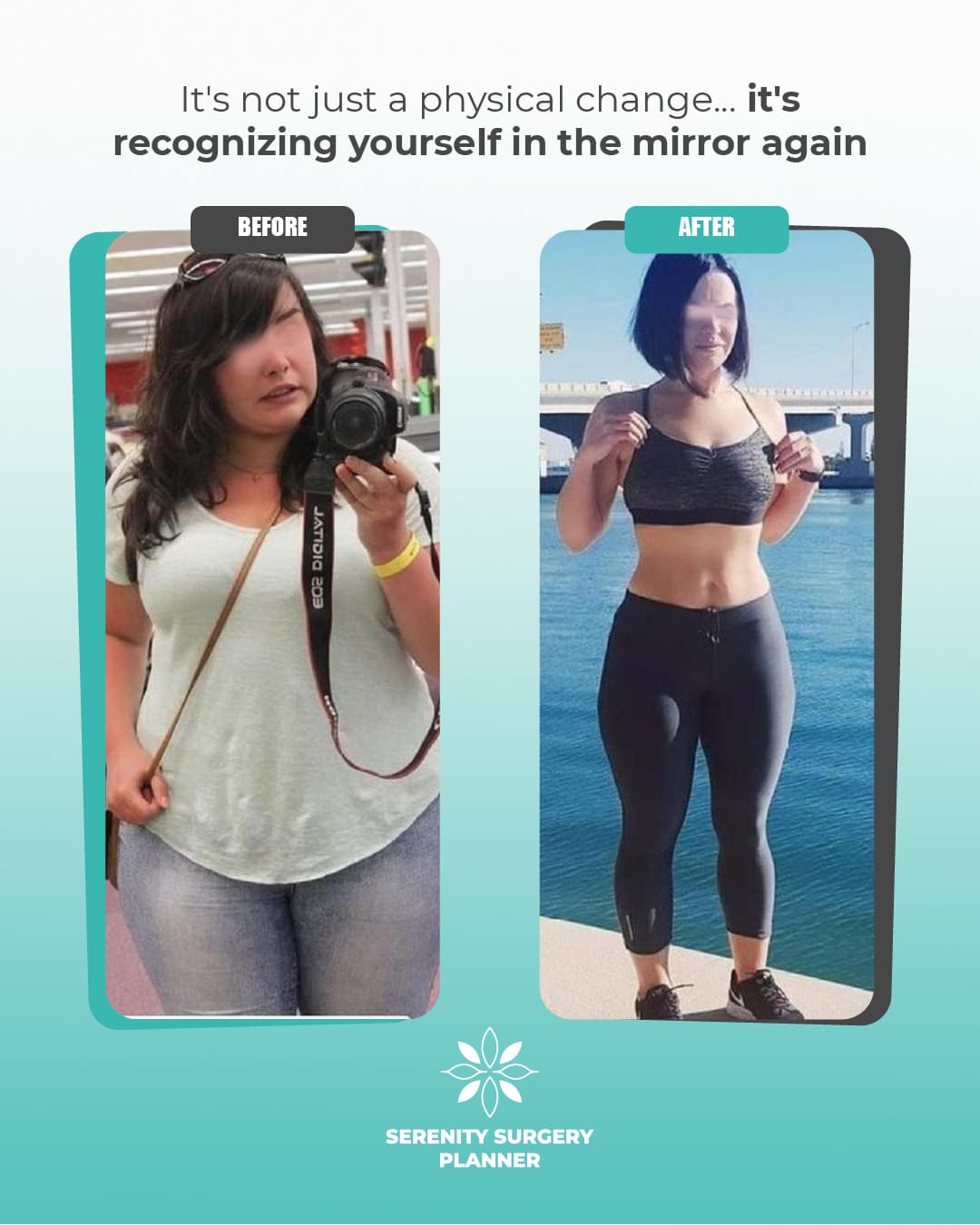 before and after