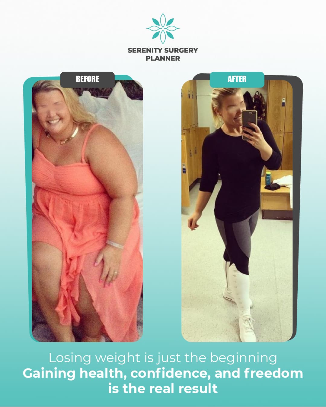 before and after