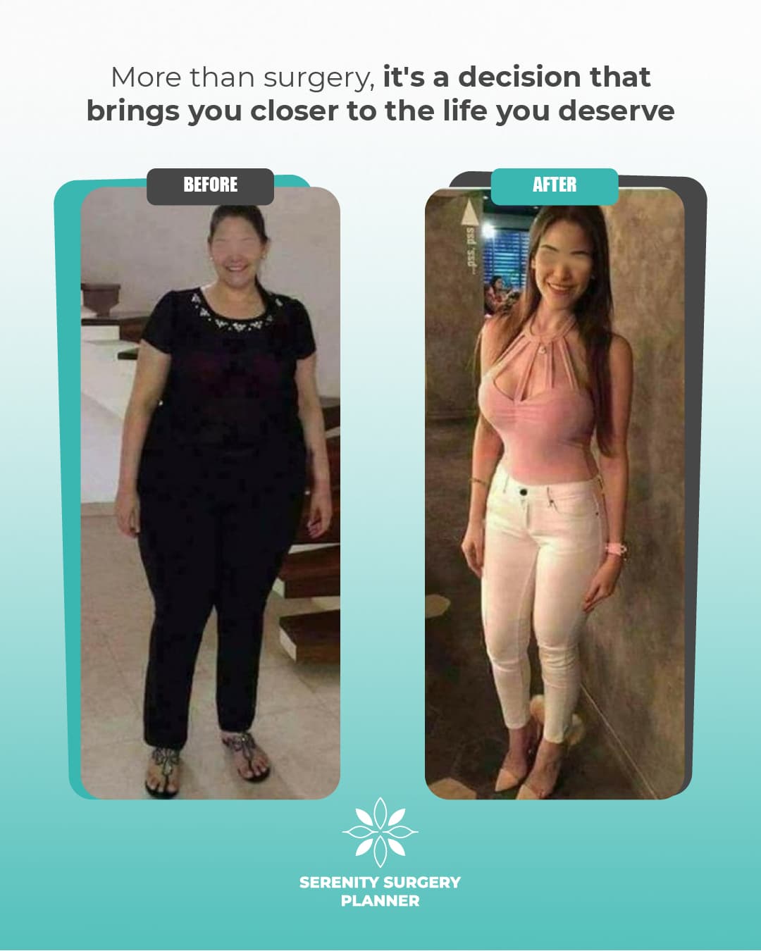 before and after